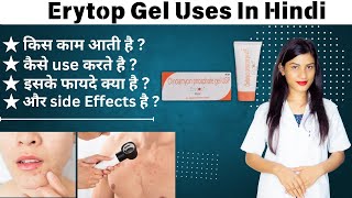 Erytop Gel For Acne Marks Erytop Gel Kaise Use Kare Erytop Gel Review Erytop Gel For Pimples