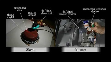 Cutaneous Feedback of Fingertip Deformation and Vibration for Palpation in Robotic Surgery