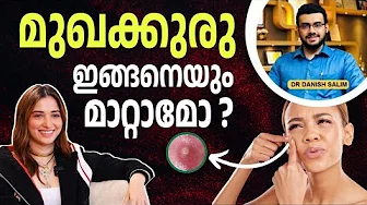2291 : മുഖക്കുരു മാറ്റാൻ Tips | Tamannaah's Pimple Secret?