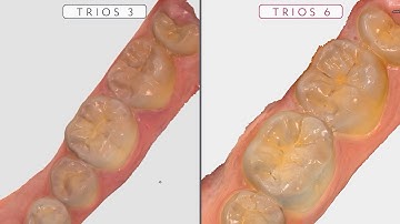 Our newest addition to the TRIOS family is taking the world by storm.