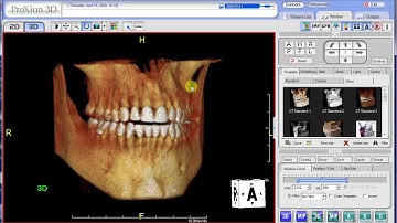 PreXion Training Tips: 3D Viewer outline tabs and icons - Part 1