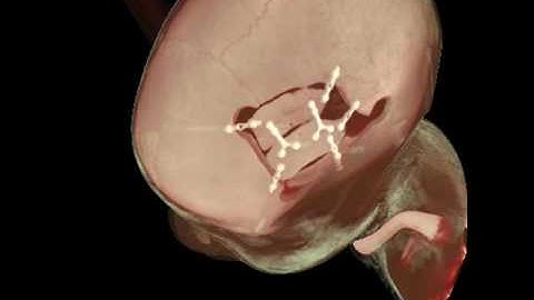 Volumetric rendering of 3D medical scans in the cloud