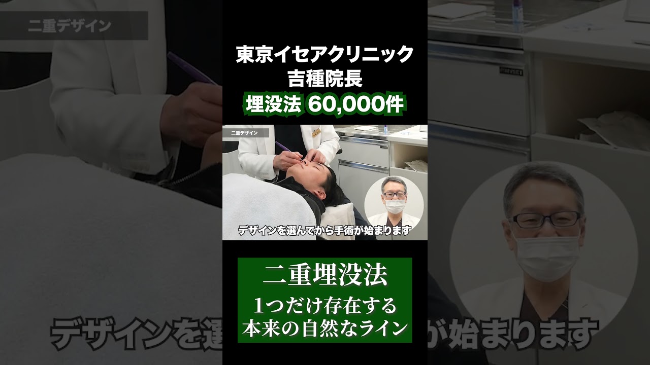 【1つだけ】二重埋没法の自然なライン