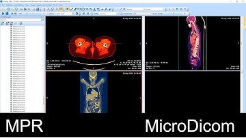 Multiplanar Reconstruction (MPR) in MicroDicom