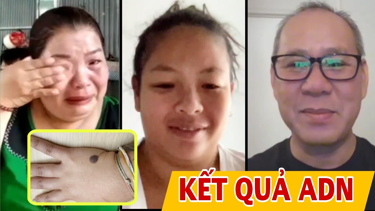 ( 2130 ) Giải mã cái bớt trên cánh tay. Cháu bên Pháp tìm về có phải con của chị Vàng không ?