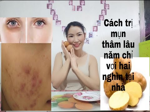 Cách TRỊ MỤN THÂM thần tốc hiệu quả chỉ với 1 loại thần dược  hai nghìn đồng tại nhà