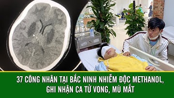 37 CÔNG NHÂN TẠI BẮC NINH NHIỄM ĐỘC METHANOL, GHI NHẬN CA TỬ VONG, MÙ MẮT | VTC16