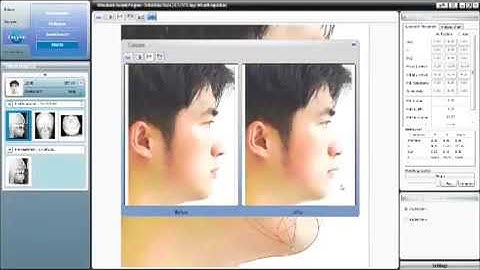 Introducing OrthoVision by Vatech