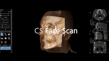 Introducing the CS 9600 CBCT Scanner