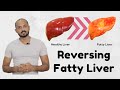 Fatty Liver - What exactly is it and how can you manage it?