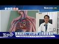 竇房結退化! 恐心跳慢 出現嚴重暈厥｜十點不一樣20260602@TVBSNEWS01