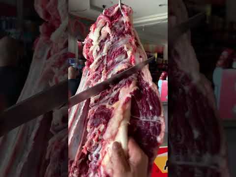 الرقبة والسن