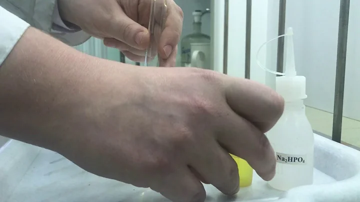 Particular (general) reactions of uranium. UO2(NO3)2 + Na2HPO4