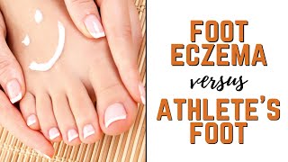 Types of Foot Eczema vs. Athlete's Feet: Symptoms, Causes & Natural Treatments