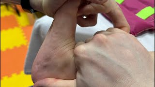Исправляю эквинус (цыпочки). ДЦП, 5 лет, правосторонний гемипарез. Методика Фролкова С.В.