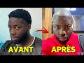 MA TRANSFORMATION CAPILLAIRE (greffe de cheveux)