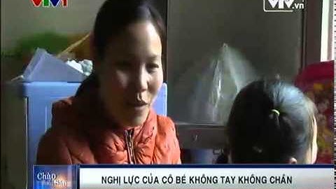 Nghị lực phi thường của cô bé không tay, không chân