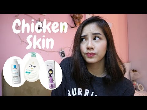 Video: Keratosis Pilaris (Kulit Ayam): Gambar, Sebab, Dan Rawatan