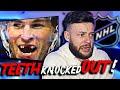 The SOCCER FAN Reacts to TEETH getting KNOCKED OUT in the NHL  ||  THIS IS HORROR