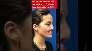 23-yr-old model who lost her lip in dog attack in US sharespicof transformation#viral#youtubeshorts 23-yr-old model who lost her lip in dog attack in US sharespicof transformation#viral#youtubeshorts