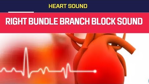 Right Bundle Branch Block Murmur sound| Right Bundle Branch Block