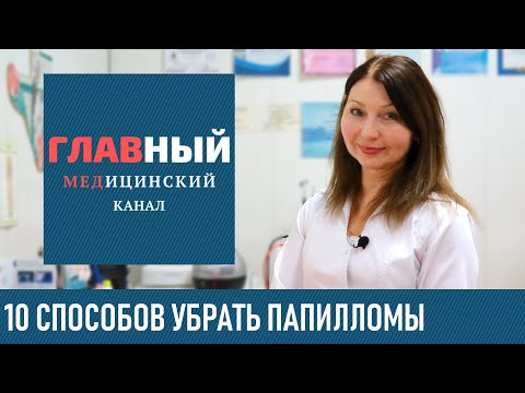 Как убрать Папилломы - ТОП-10 способов в домашних условиях. Лечение папиллом народными средствами