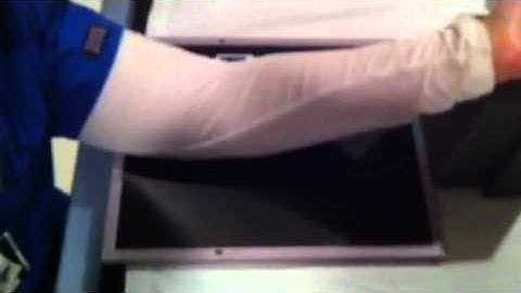 Xray - Elbow (Partial Flexion)