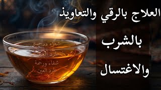 شاهد بعينك خروج السحر والحسد من جسدك في دقائق | الطريقة الصحيحة مع سعيد عنان
