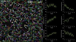 Improve the accuracy of cell metrics using EVE Analytics from Nanolive