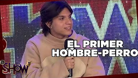 Primer hombre que se siente perro | Es Show