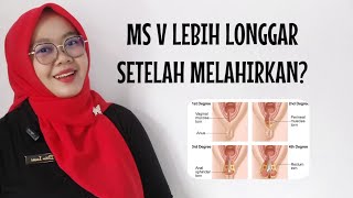 APAKAH MISS V LEBIH LONGGAR SETELAH MELAHIRKAN? BIDAN ISNA