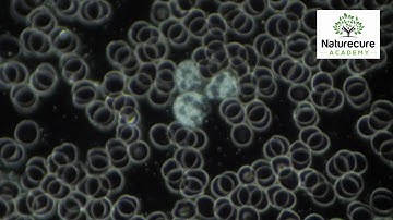 Timelapse of Blood Under a Microscope - Live Blood Analysis Training