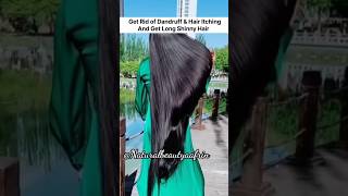 ?Remove Dandruff ?✅ shorts haircare hairgrowth  viral viralvideo