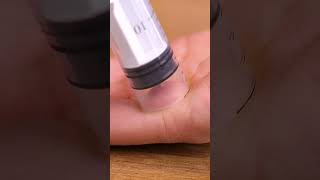Stuck Splinter Gets Removed Easily