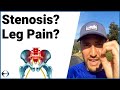 Is Sciatica or Stenosis Causing You to Feel Pain Down the Legs While Walking or Running?