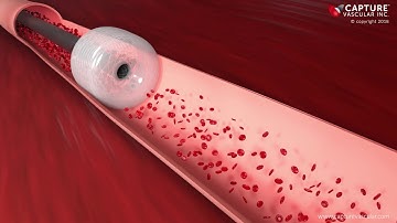 Capture Vascular Peripheral Animation