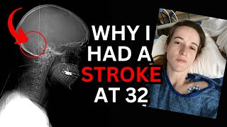 4 Months After Having a Stroke: Why It Happened & Where It Left Me