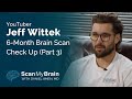 YouTuber Jeff Wittek's Accident (The 6-Month Brain Scan Check Up) // Scan My Brain