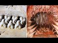 15 Strangest Teeth In The Animal Kingdom