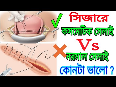 ভিডিও: সাধারণ সেলাই: ভোজ্য বা না, বিবরণ। মাশরুম বাছাইয়ের গাইড