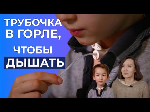 АТРЕЗИЯ ТРАХЕИ | История Ветошкина Филиппа