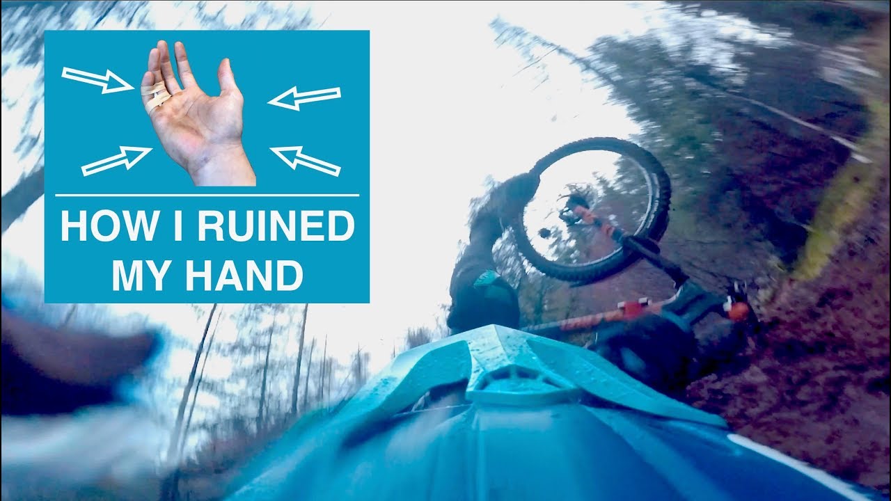 black mirror season 5 How I ruined my hand....