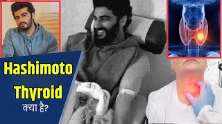 Arjun Kapoor Opens Up About Hashimotos Disease कय ह हशमट और इसक लकषण