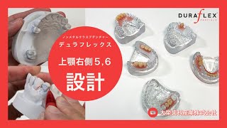 【デュラフレックス】ノンメタルクラスプデンチャー設計のポイント