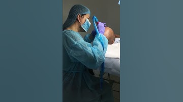 Scalp Micropigmentation in action