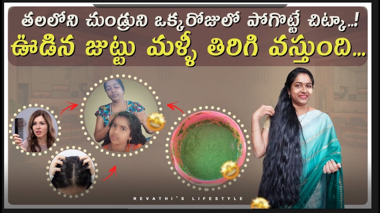 🔥తలలో చుండ్రు,దురద తగ్గి ఊడిన జుట్టు మొత్తం తిరిగి మళ్లీ పొడవుగా వస్తుంది / Get rid of Dandruff