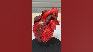 #heartdisease #heartstructure #heartfailure #medicalcodingtraining