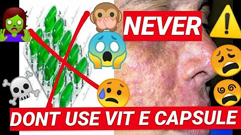 💚VIT E CAPSULE💚 - ⚠️ never ⚠️ | why you should never use the capsules.