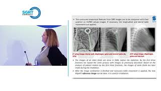 Implementation of AlignRT System for Marker less Patient Positioning and Radiation Control in our Da