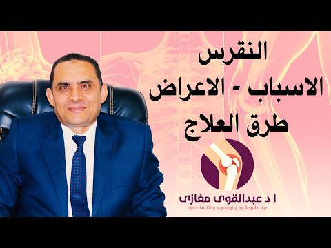 فيديو: النقرس عند النساء والرجال: ما هو ، الأعراض ، الصور على الساقين